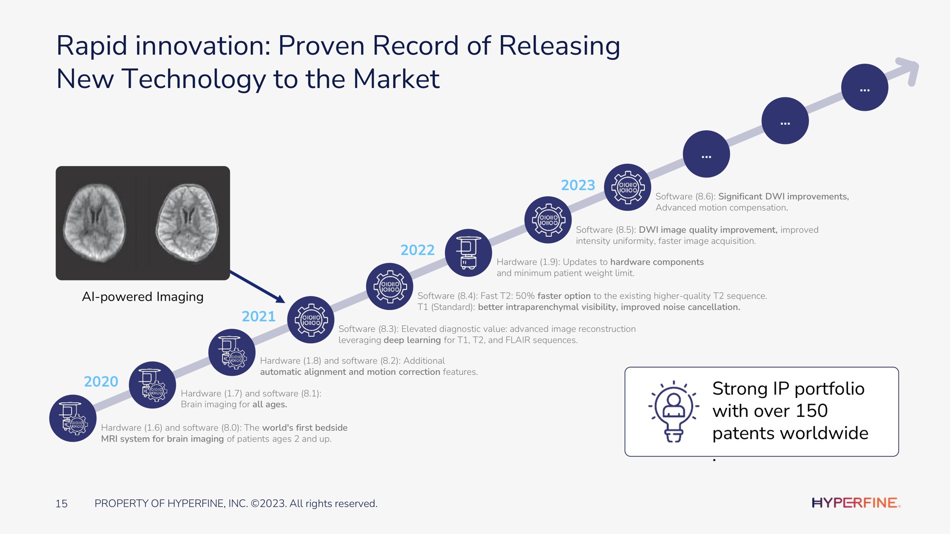 rapid innovation proven record of releasing new technology to the market | Hyperfine