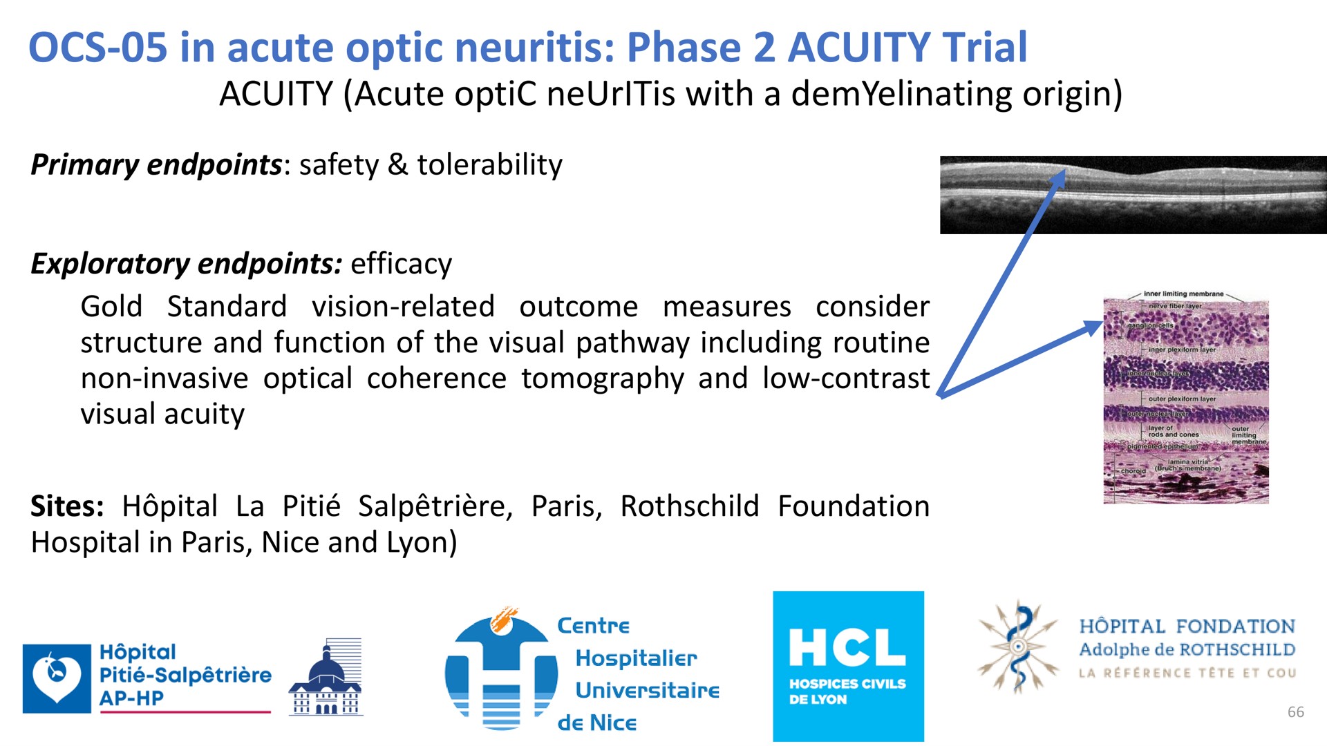 in acute optic neuritis phase acuity trial acuity acute optic neuritis with a origin | Oculis