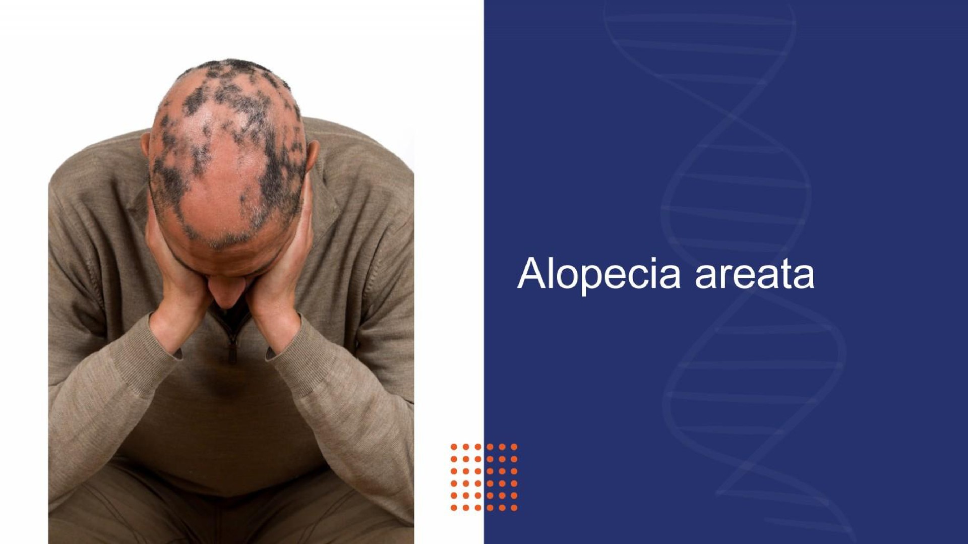 alopecia | Zurabio